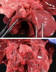 <p>Case: Mel, 2-yo, FS, Chihuahua dog </p><p>Severe hypoxemia, respiratory distress, pleural effusion, scant pericardial effusion. </p><p>Diagnoses?</p><p>What type of ventricular overload is expected? </p><p>What secondary findings can be seen?</p>