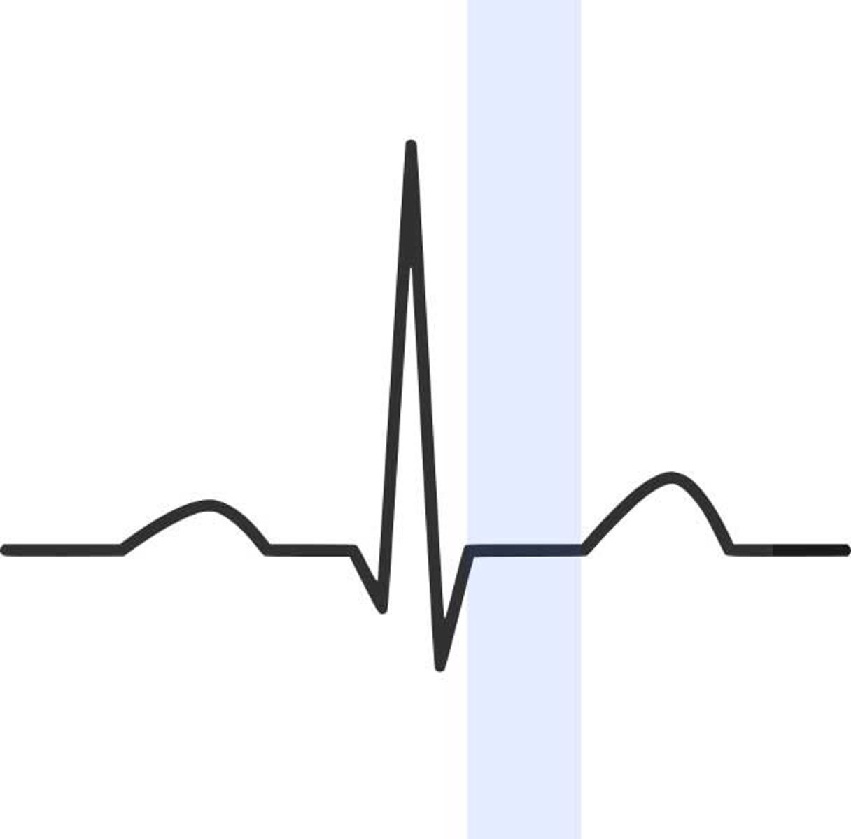 <p>elevated during MI (myocardial infarction, heart attack)</p>