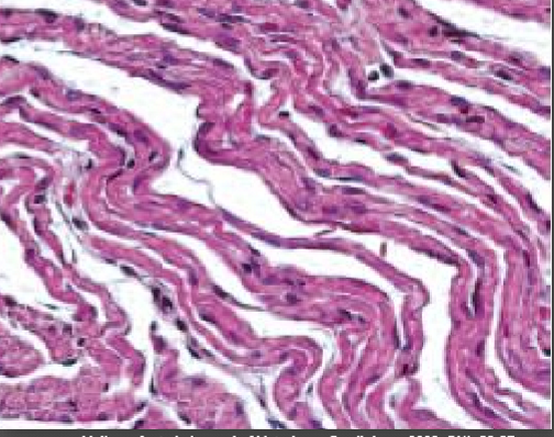 <p>Identify the condition?</p>