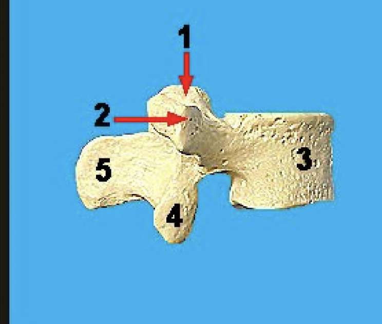 <p>what vertebra is this and what view</p>