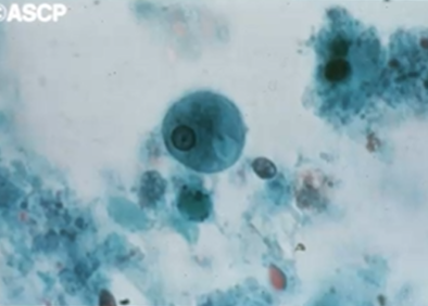 <p><span style="background-color: rgba(0, 0, 0, 0); line-height: 19.7625px;">What is the species seen in this photo and WHY?</span></p>