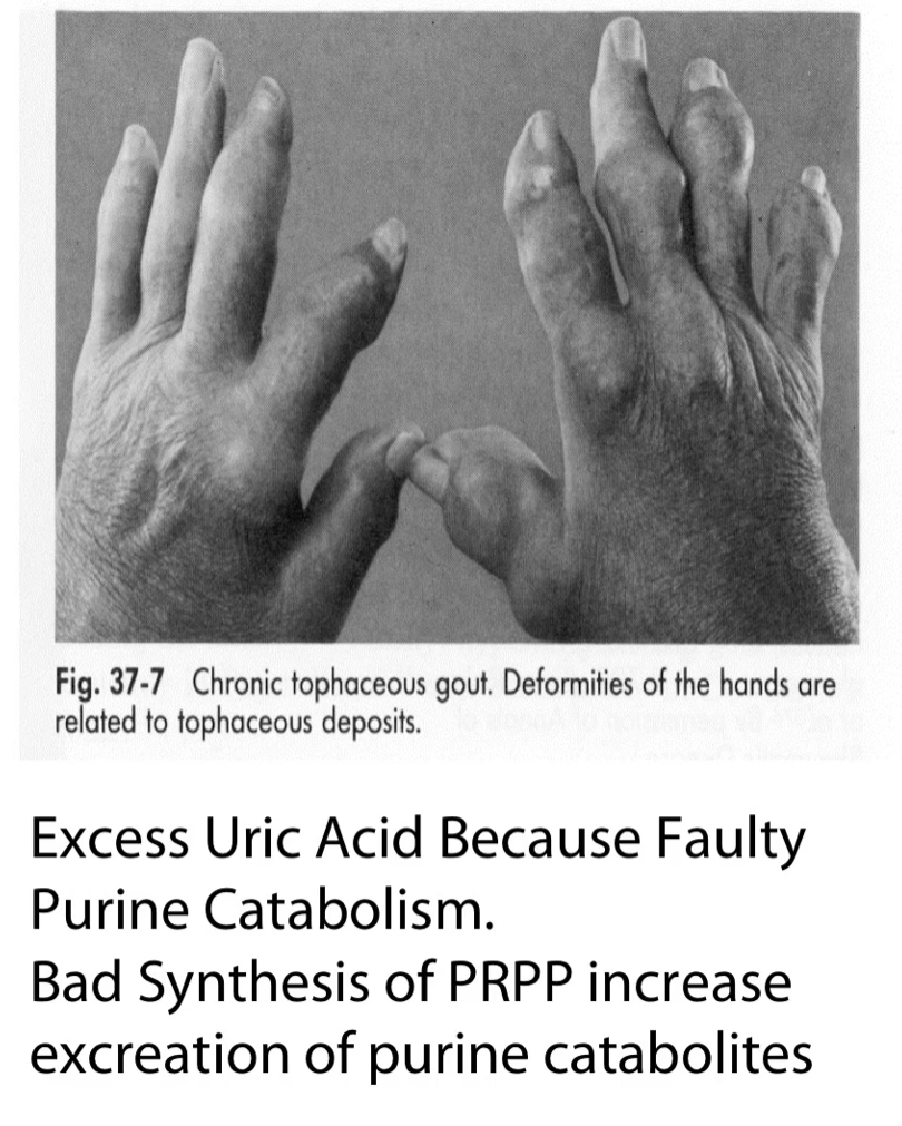 <p>Uric acid <span data-name="abc" data-type="emoji">🔤</span> Etymology </p><ul><li><p><strong>Uric</strong> → from “urine” (it’s excreted there)</p></li><li><p><strong>Acid</strong> → weak organic acid</p></li></ul><p><span data-name="point_right" data-type="emoji">👉</span> <strong>“The end product of purine breakdown that is excreted in urine.”</strong></p>
