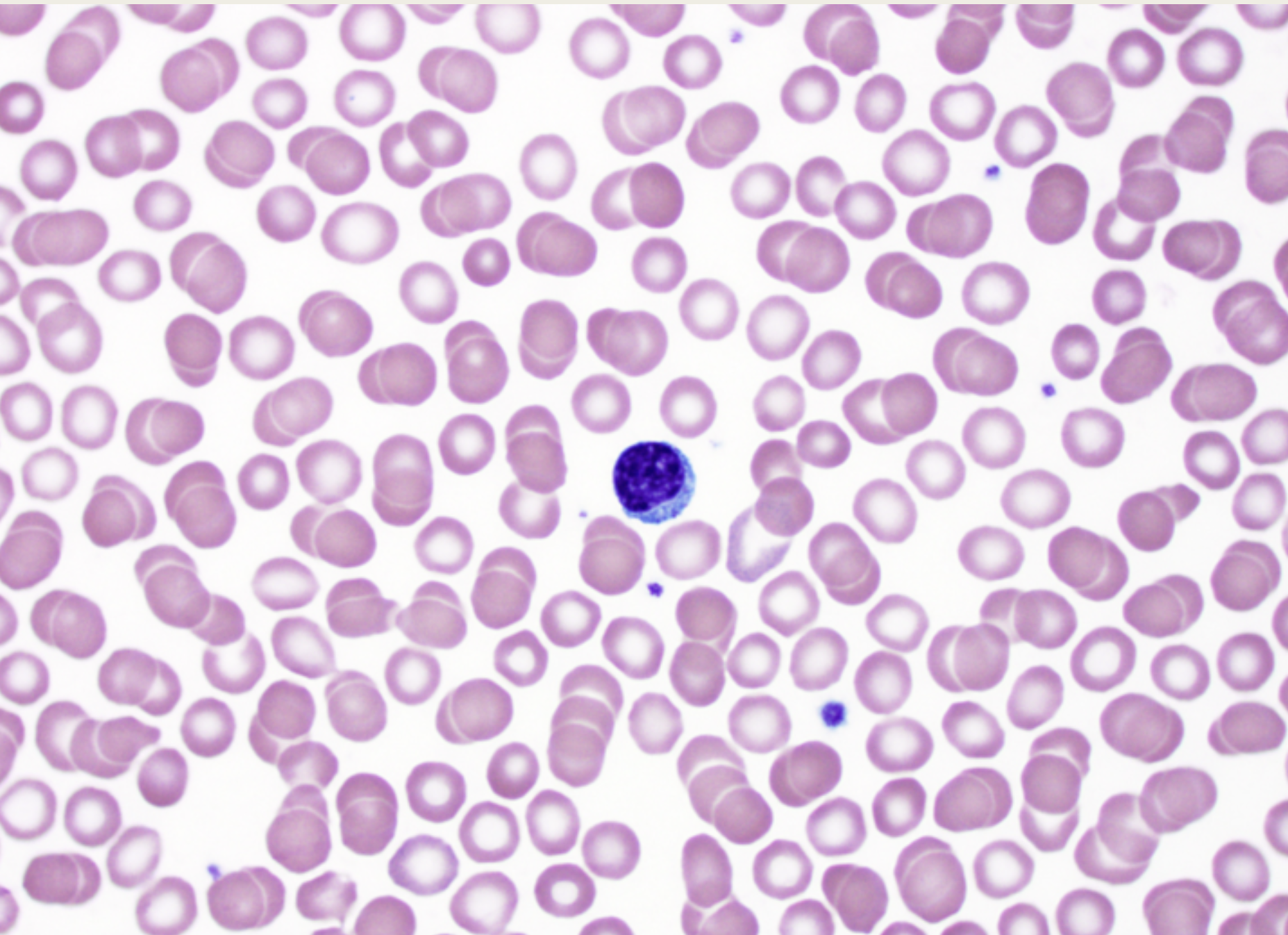 <p>Lymphocytes</p><p>■ One XX,XX</p><p>nucleus</p><p>■ XX</p><p>■ XX WBC</p><p>■ XX Types (X cells &amp; X</p><p>Cells)</p><p></p>