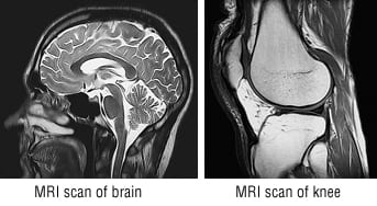 <p><strong>MRI</strong></p>