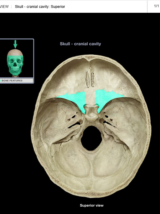 <p>Lesser wing of sphenoid bone</p>