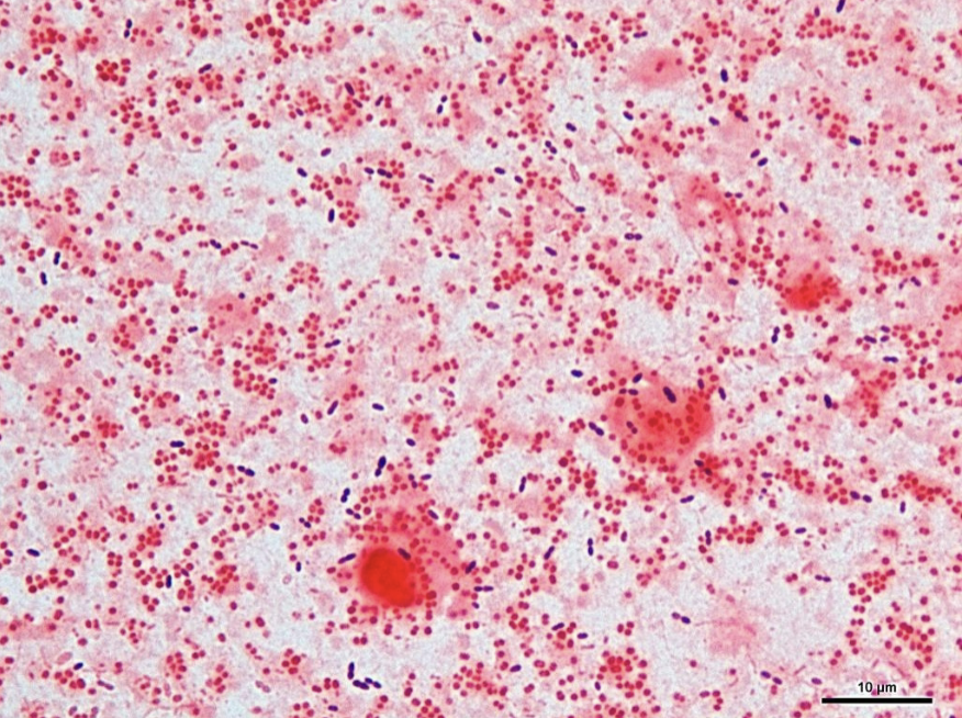 <ul><li><p>GN diplococci w/ “kissing” morphology </p></li><li><p>colony: opaque gray to white, “hockey puck” slide </p></li><li><p>infections </p><ul><li><p>upper and lower respiratory infections </p><ul><li><p>otitis media, sinusitis, pneumoniae, eye infections </p></li></ul></li></ul></li><li><p>testing </p><ul><li><p>oxidase (+)</p></li><li><p>assachroytic</p></li><li><p>no growth on Thayer-Martin</p></li><li><p>positive catarrhalis disk </p></li></ul></li></ul><p></p>