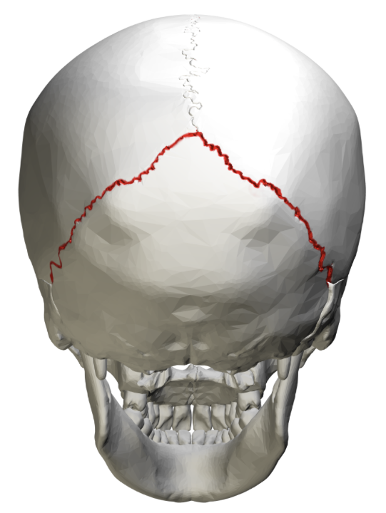 <p>Welk sutuur is dit?</p>