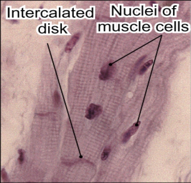 <p>Pink: Intercalated disk</p><p>Green: Nuclei of muscle cells</p>