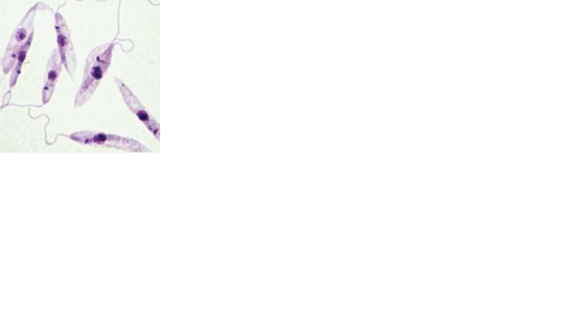 <p>Name the protozoan</p>