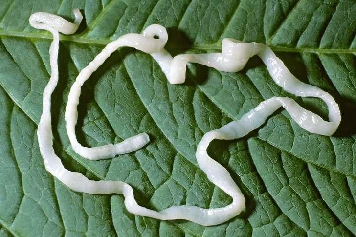 <p><span>Tapeworm Image</span></p>