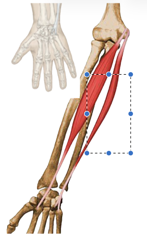 <p>What muscle is being shown? </p>