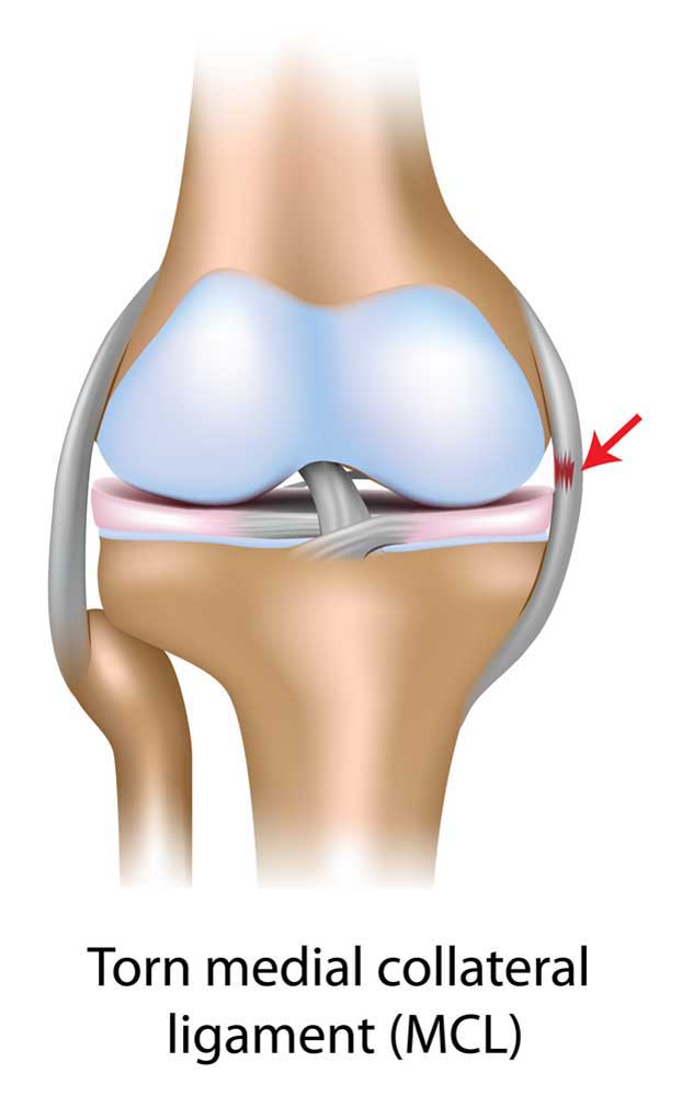<p><strong>ligament</strong></p>