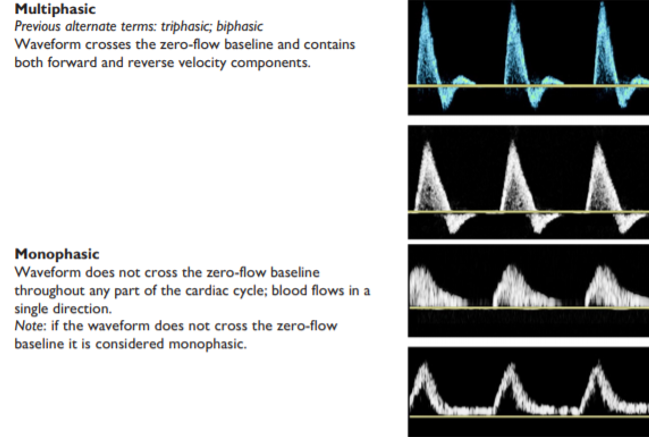 <p>the phasicity of the waveform</p>
