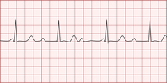 <p>identify the rhythm</p>