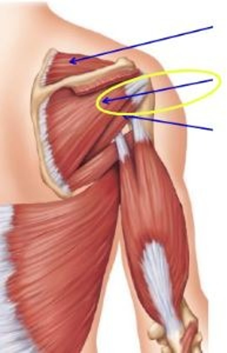 <p>rotator cuff muscle, originates on the infraspinous fossa of the scapula and inserts on the humerus</p>