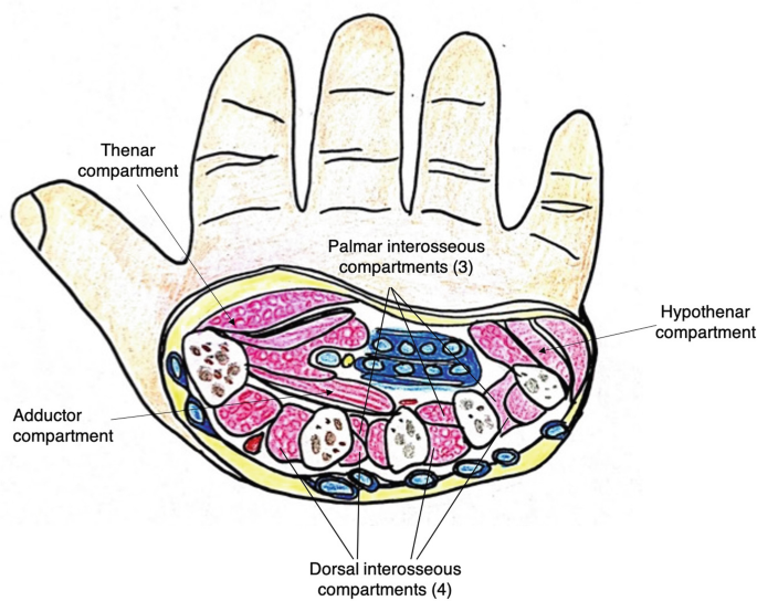 <p>Thenar, hypothenar, central, and adductor (deepest) compartments</p>