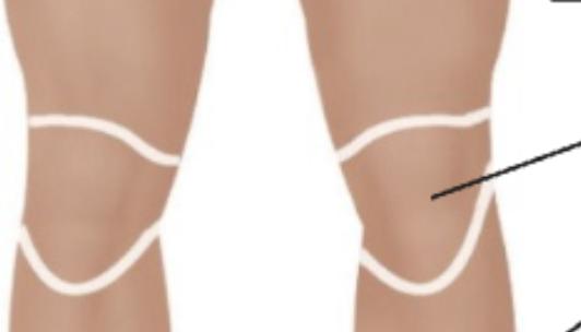 <p>Front of knee. </p>
