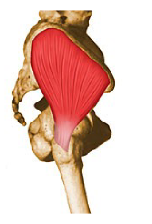 <p>What muscle is this? <br>Name, Origin, Insertion, Action, Exercise </p>