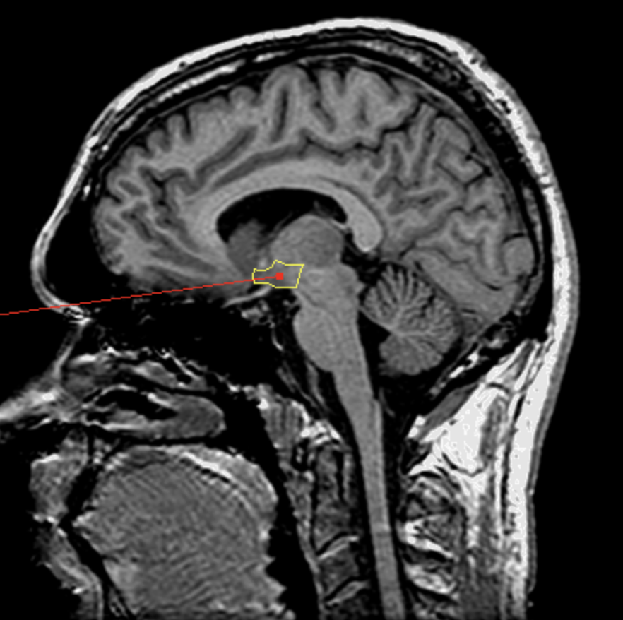 <p>What is the area highlighted called?</p>