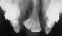 <ol start="3"><li><p>What do you see and what caused it?</p></li></ol><p></p>