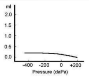 <p>What tympanogram would you see with an individual with fluid in the ME?</p>