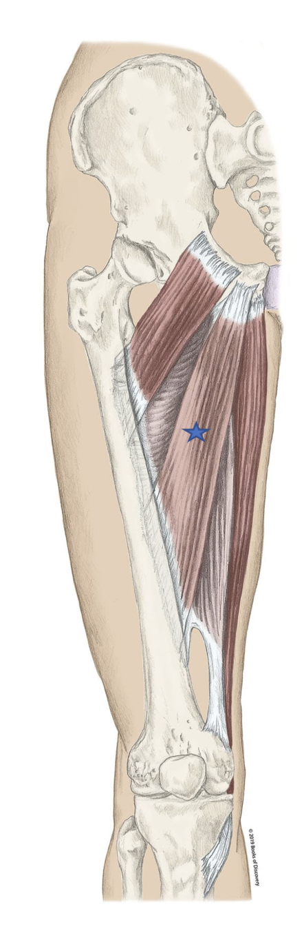 <p><span>From the list of muscles and actions below, identify the "starred" muscle and its primary actions.</span></p>