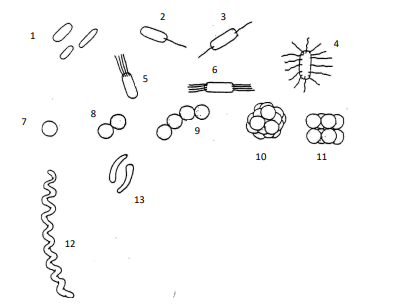 <p>omschrijf de vorm, groepering en flagelleringstype van de bacteriën op de afbeelding</p>