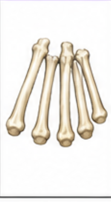<p>What bone is this?</p>