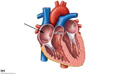 <p>what part of the heart is this? Receives deoxygenated blood from the body</p>