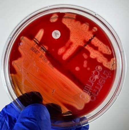 <p>What type of hemolysis pattern is this?</p>