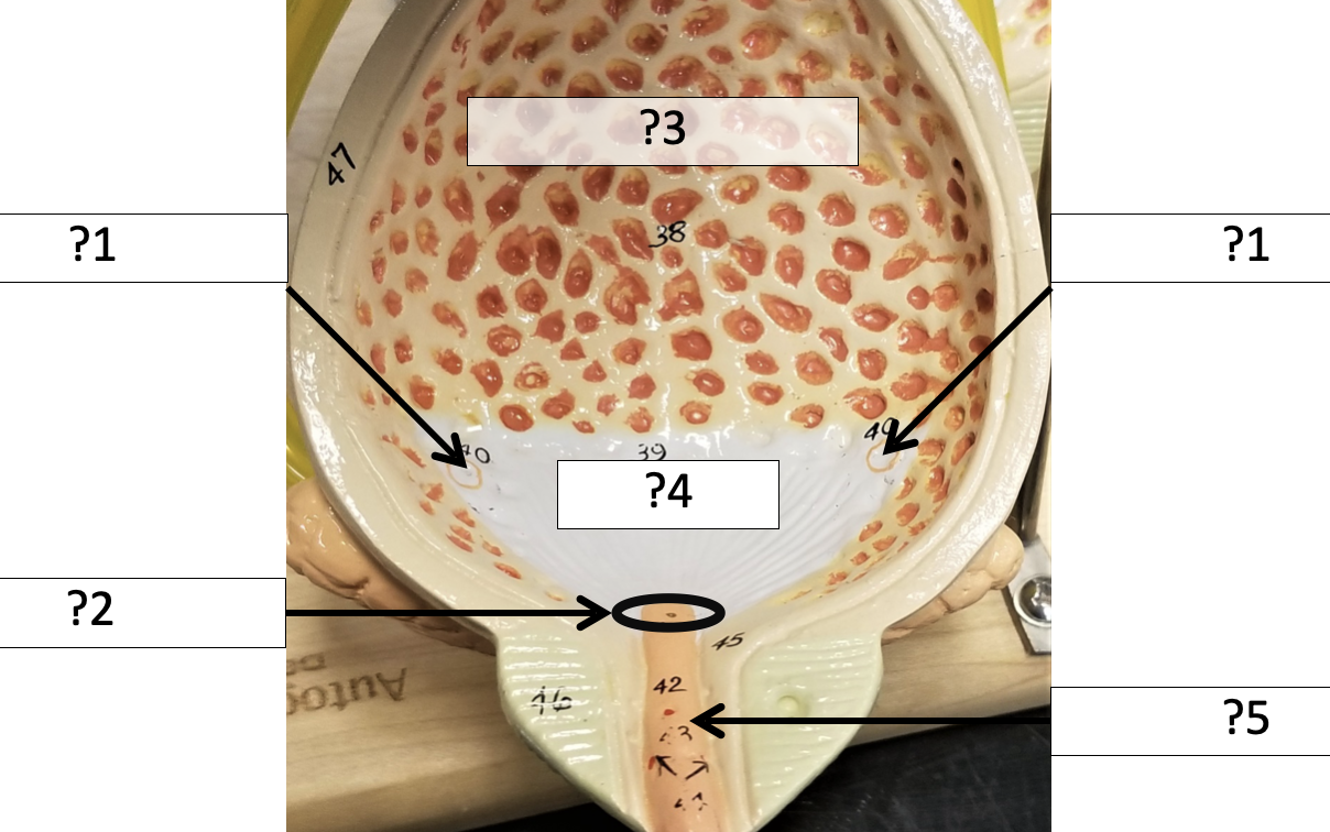 <p>2 Name the hole?</p>