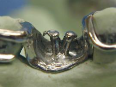 <p>ID the design of denture base minor connector:</p>
