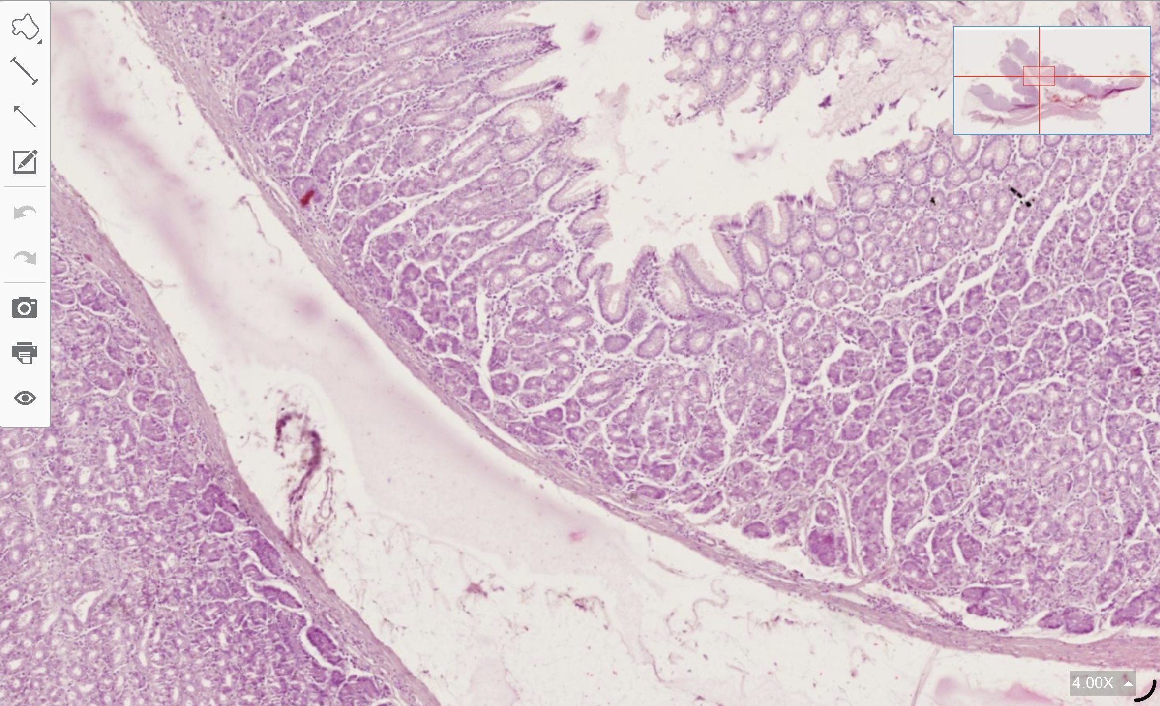term image