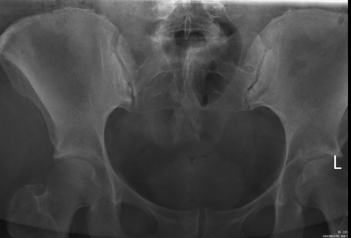 <p>critique this AP axial SI joint</p>