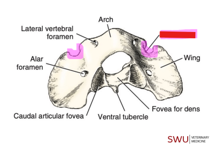 <p>Q: Located at the cranial border for the vertebral artery on the atlas is the …… </p><p>A. Transverse foramen </p><p>B. Lateral vertebral foramen </p><p>C. Alar notch </p><p>D. Alar foramen</p>