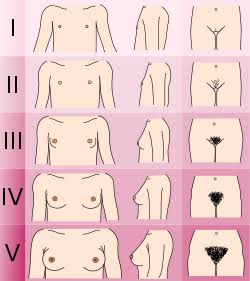 <p>Primer signo visible del desarrollo del tejido glandular mamario al inicio de la pubertad.</p>