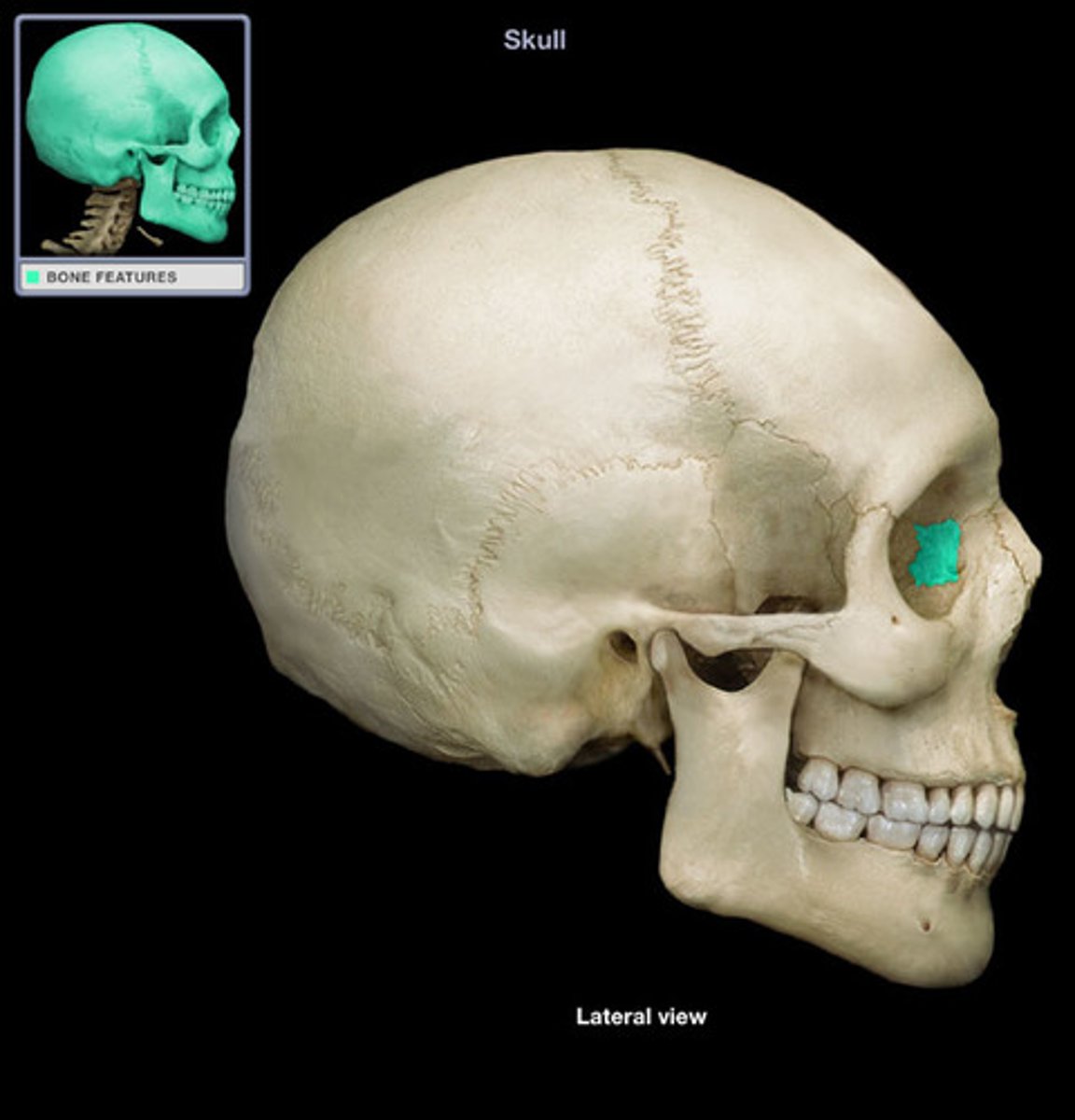 <p>ID highlighted bone</p>