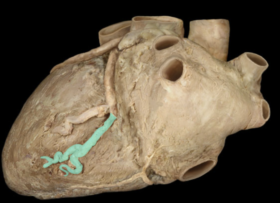 <p>Identify the feature of the right coronary artery</p>