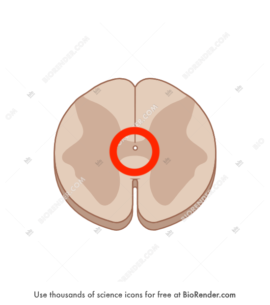 <p>hole in the very middle</p>