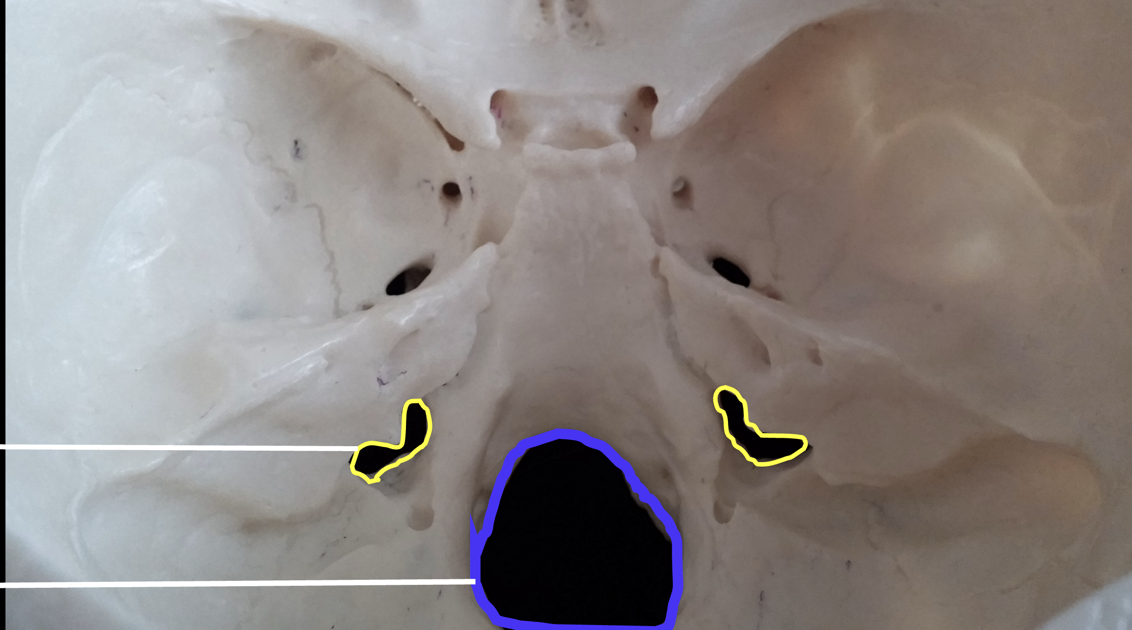 <p>Whats the yellow region highlighted on the occipital bone?</p>