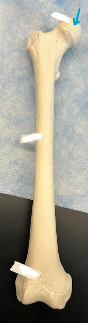 <p>ID femur region </p>