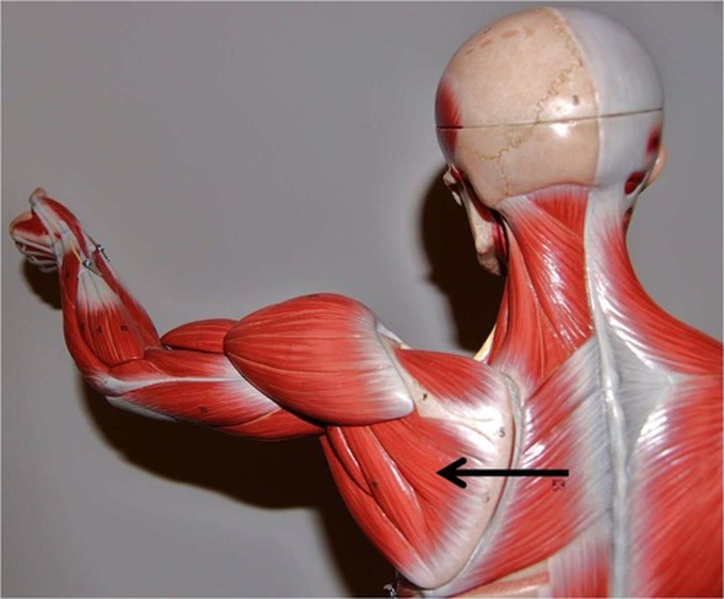 <p>Part of rotator cuff</p><p>Action - laterally rotates humorus; stabilizes the head of the humerus in glenoid cavity</p><p>Origin - infraspinous fossa of scapula</p><p>Insertion - greater tubercle of humorus</p>