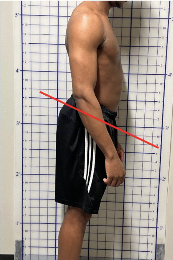 <p>anterior pelvic tilt: why?</p>