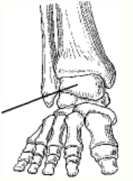 <p>The bone identified in the figure above is the:</p>