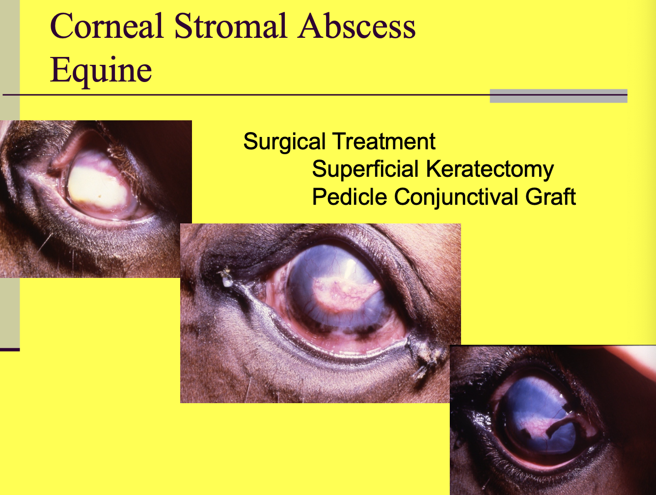 <p>Superficial keratectomy.</p><p>Pedicle conjunctival graft.</p>