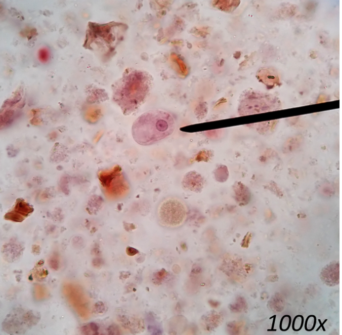 <p>What organism is this, and is it a trophozoite or a cyst?</p>