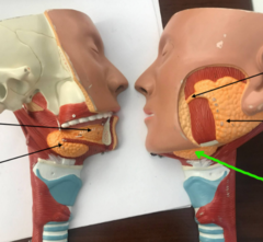 <p>What structure is the green arrow pointing to?</p>