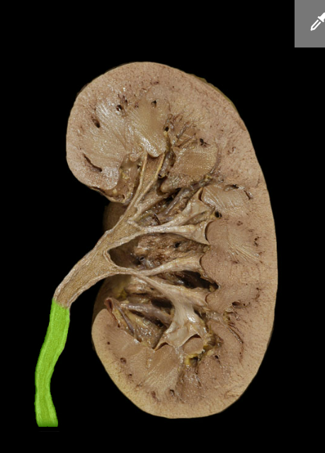 <p><span>Ureter</span></p>