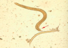 <p>what nematode is this?</p>