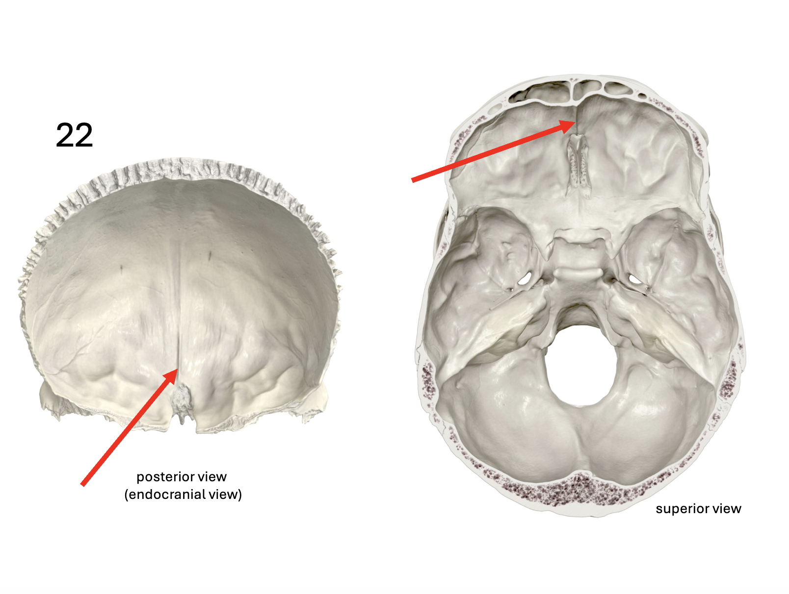 <p>Identify the <strong>bone and landmark</strong></p>